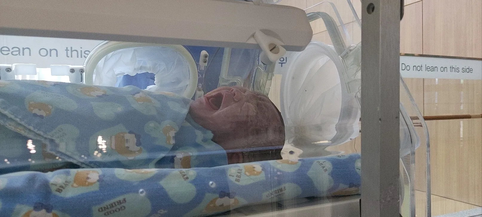 오늘 제왕절개 했어요