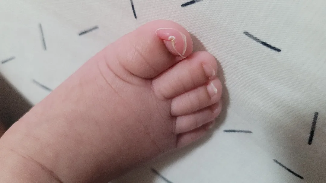 90일아기 발톱좀봐주세요 ㅠㅠㅠ