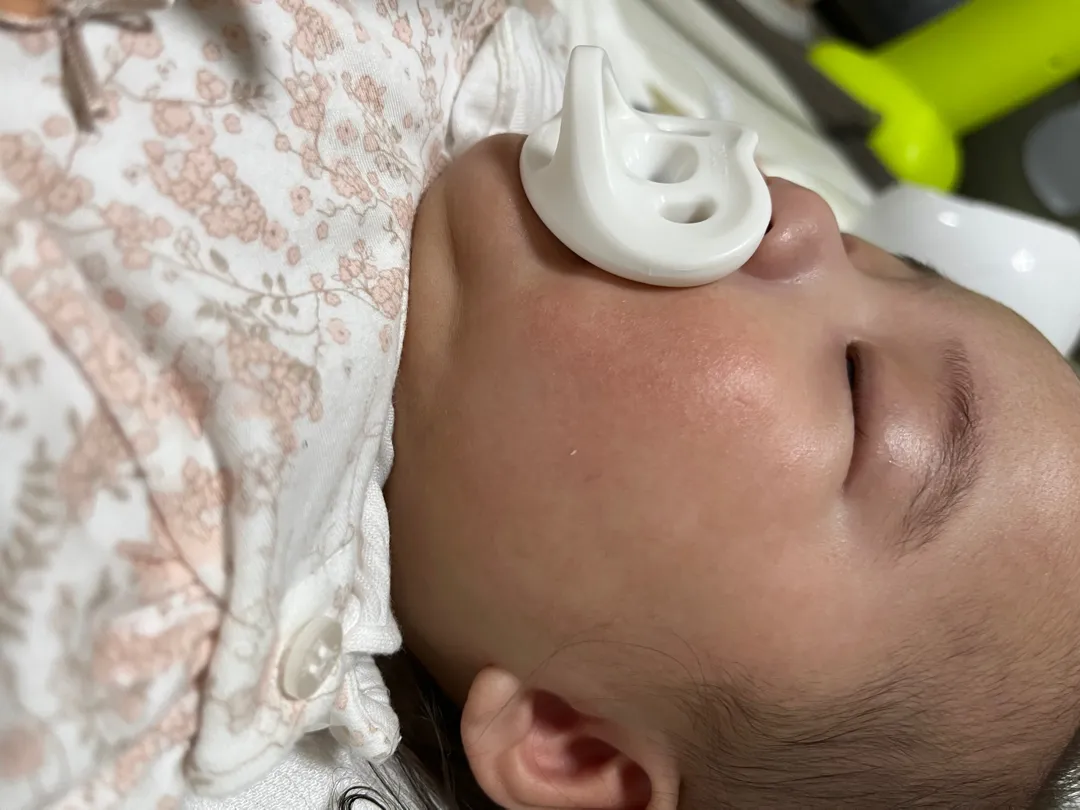 아이피부 도와주세용 ㅠㅠ 