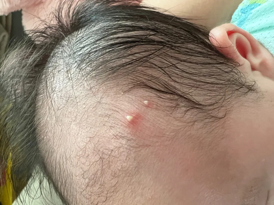 아기 두피좀 봐주세요ㅠ