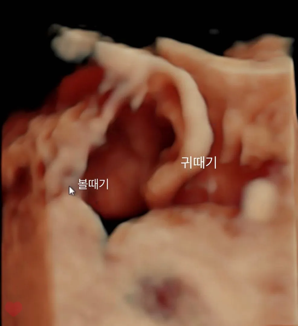 39w 6d ... D-1 🥹 언제나와줄래..?