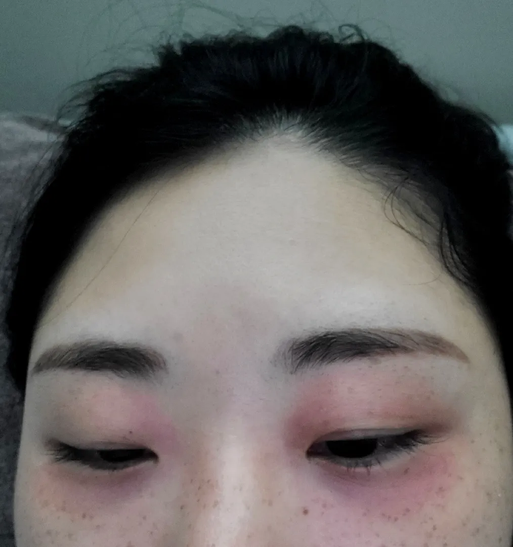 출산후 당뇨확정인거같아요ㅠㅠ