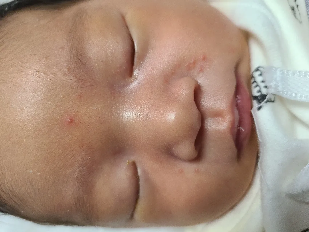 애기피부봐주세요ㅠㅠ