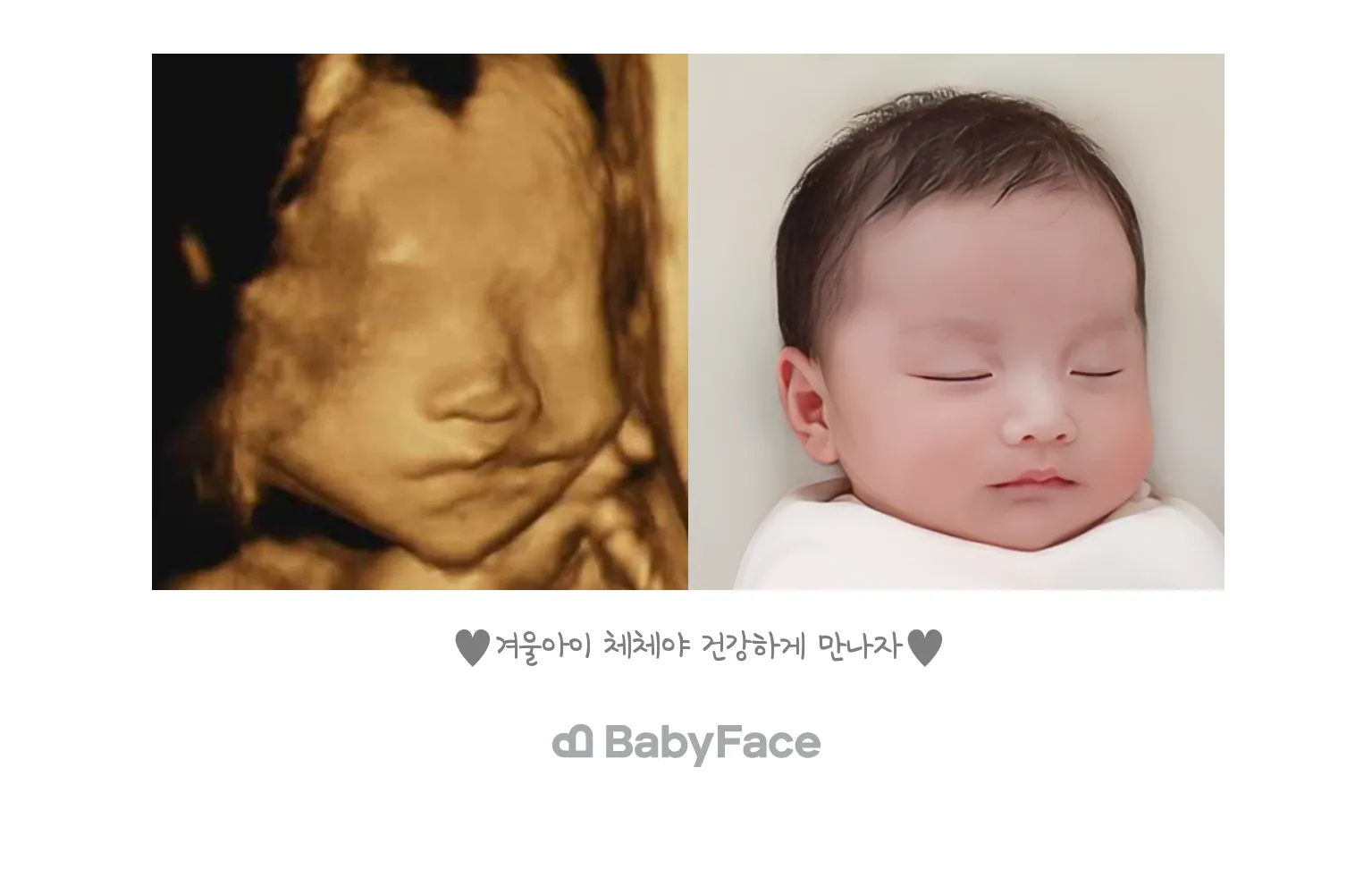 저두 고민하다가 베이비페이스 신청해봤습니다!🥰
