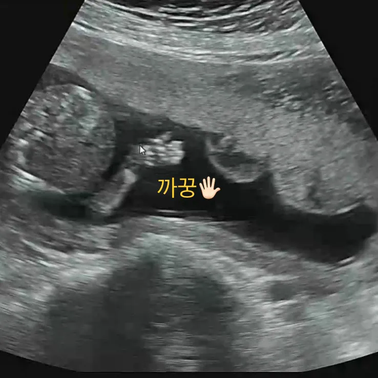 16주