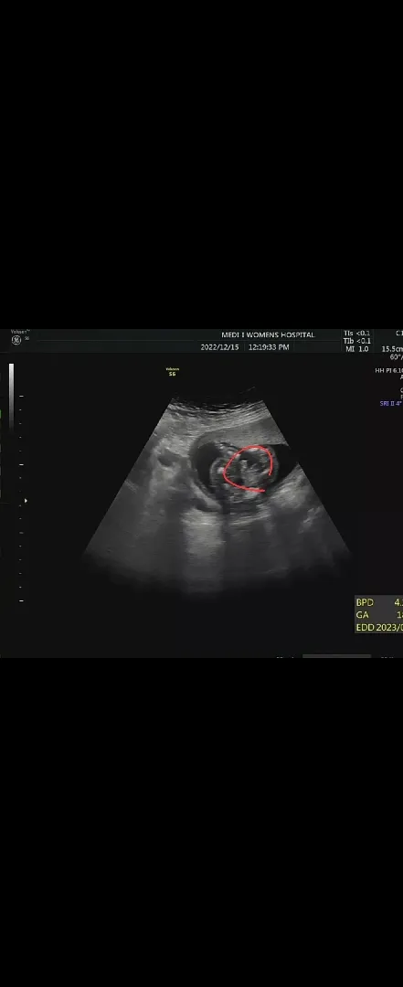 18주6일 고추가보인다는데