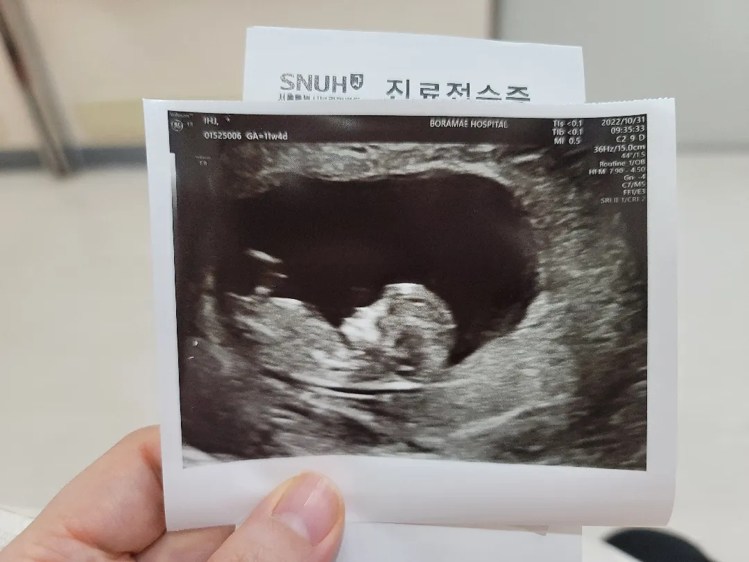 초음파 사진을 한 장씩 밖에 안주셔서 너무 속상해요.