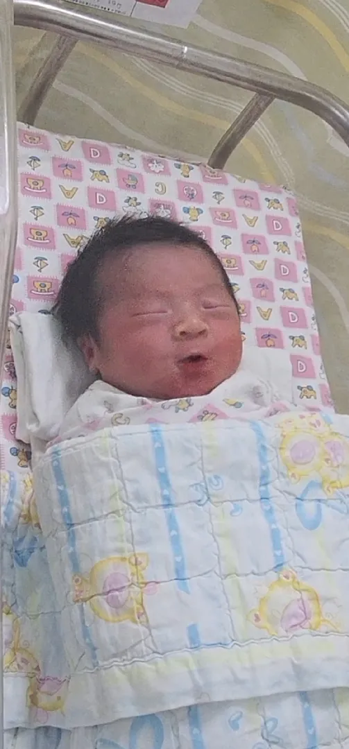 제왕절개 후 가스통