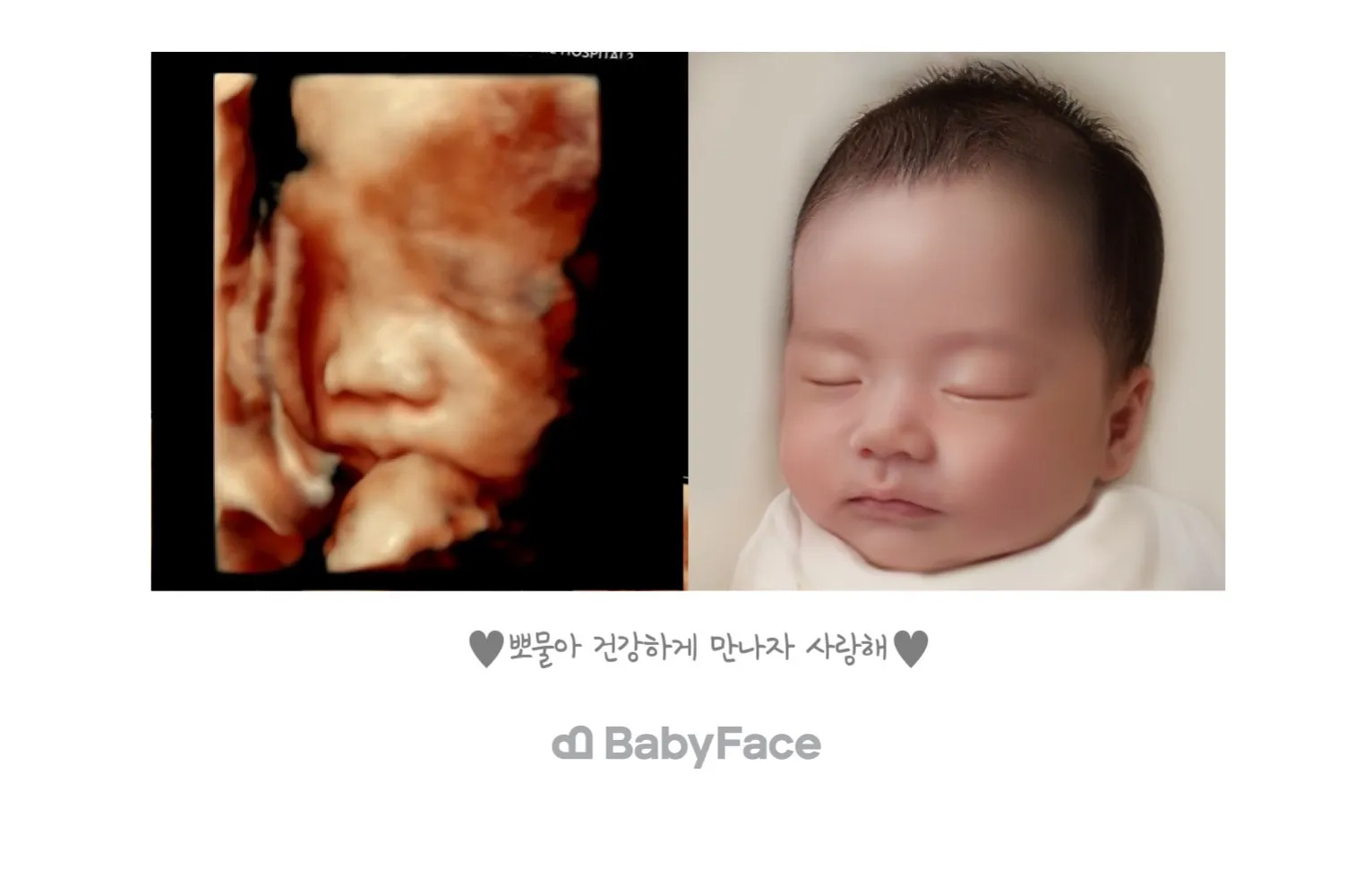 드디어 입체초음파 보고 왔어요