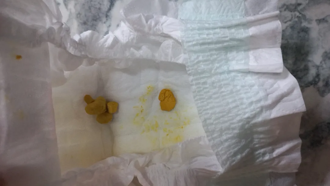 32일차인데(응가사진있어요ㅠ)