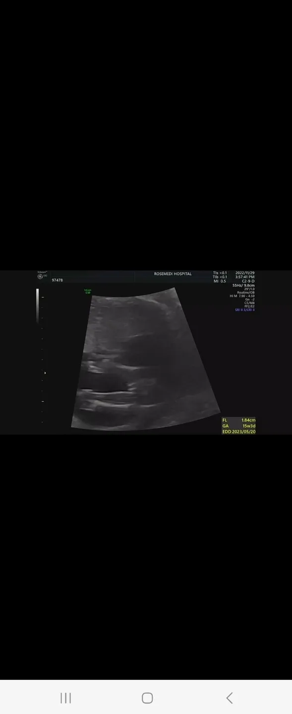 15주3일 성별 무엇일까용