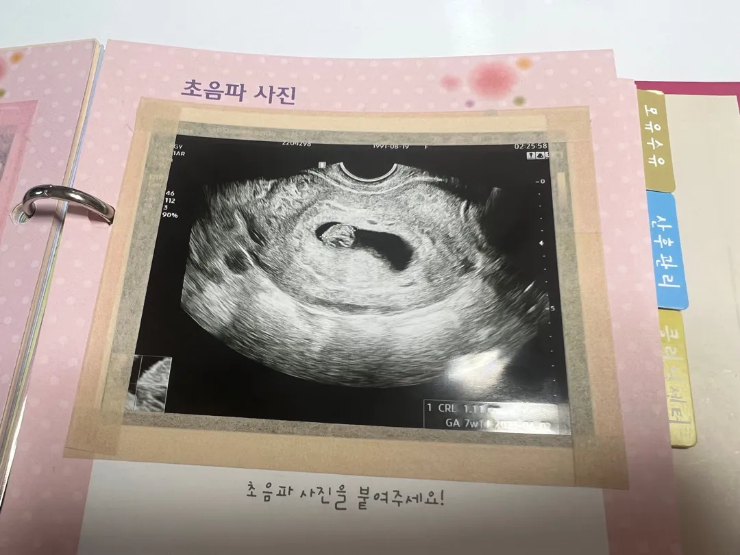 갈색혈..괜찮을까요