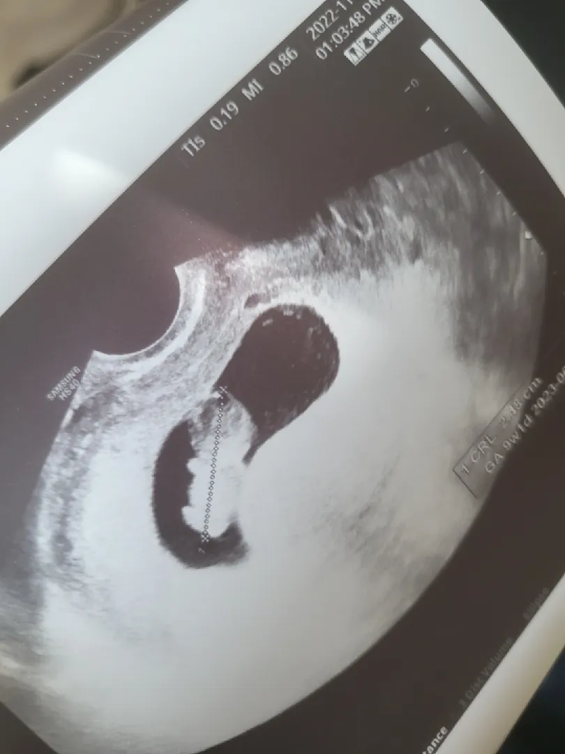 젤리곰 봤어용👶