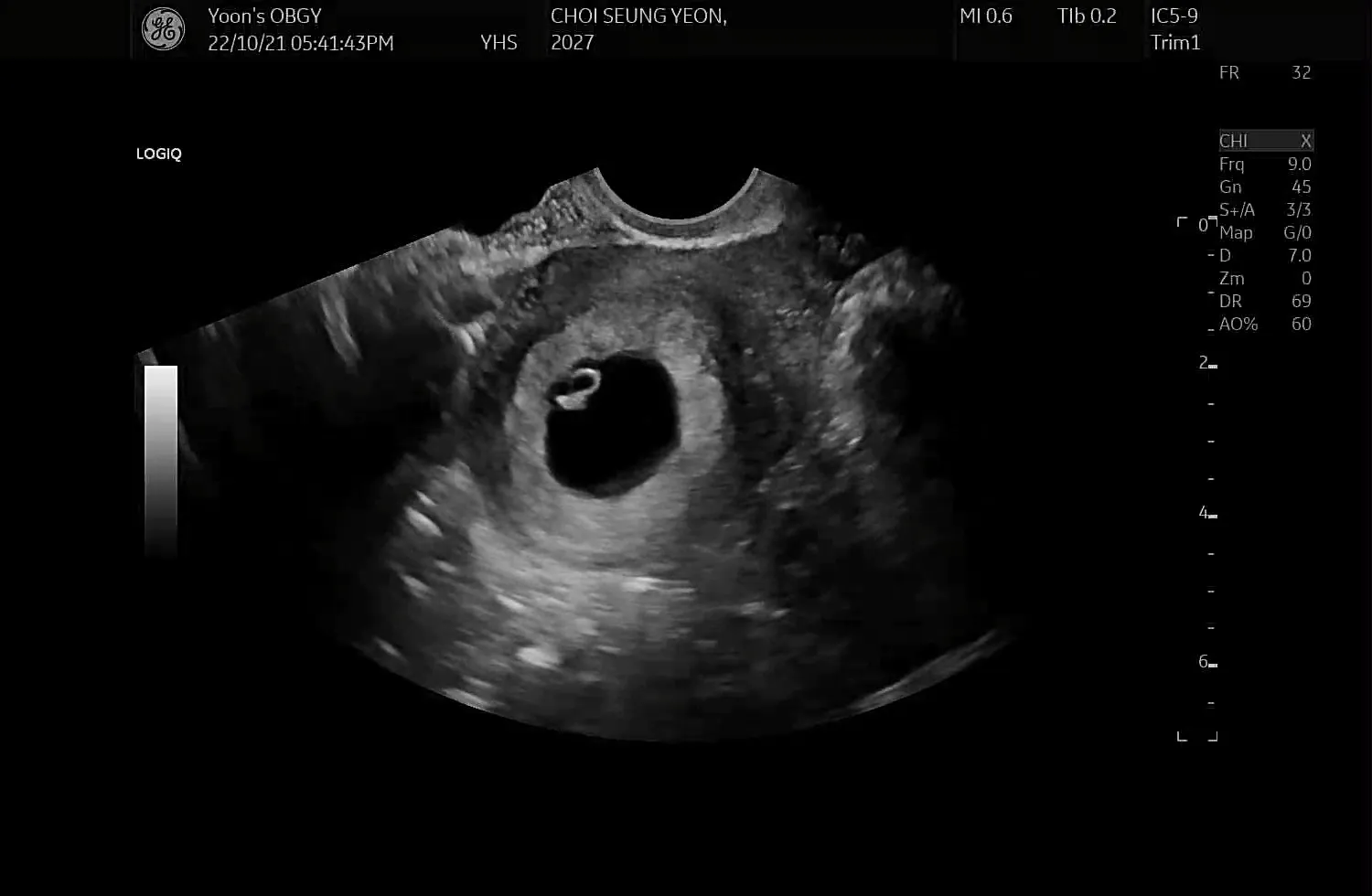 6주1일이에용👶