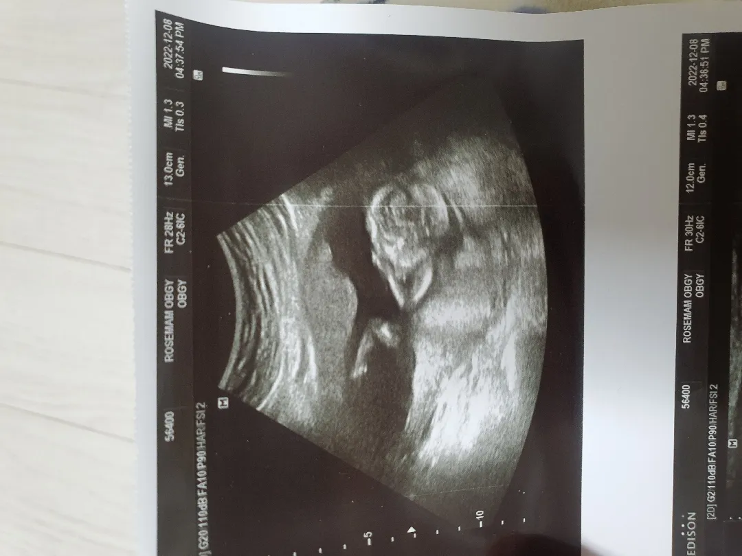 15주2일차 성별 너무 궁금하네요~ㅎㅎ