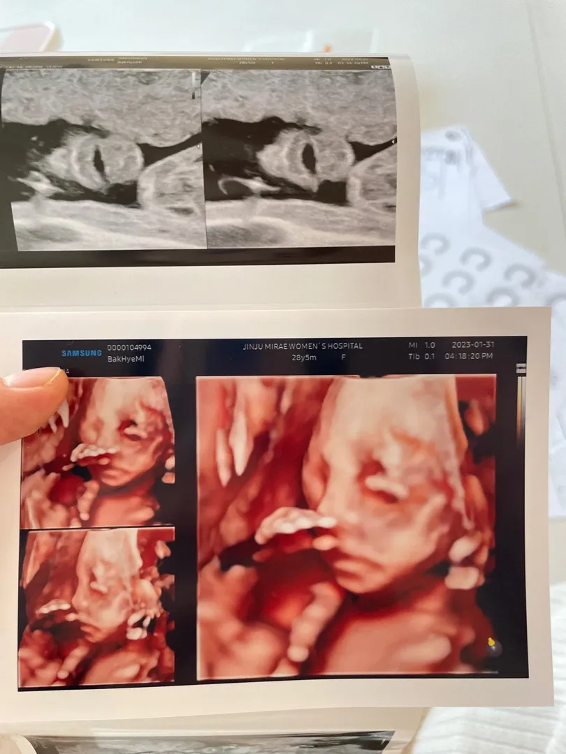 (정밀촘파) 선택제왕 자연분만중 맘들의 선택은?