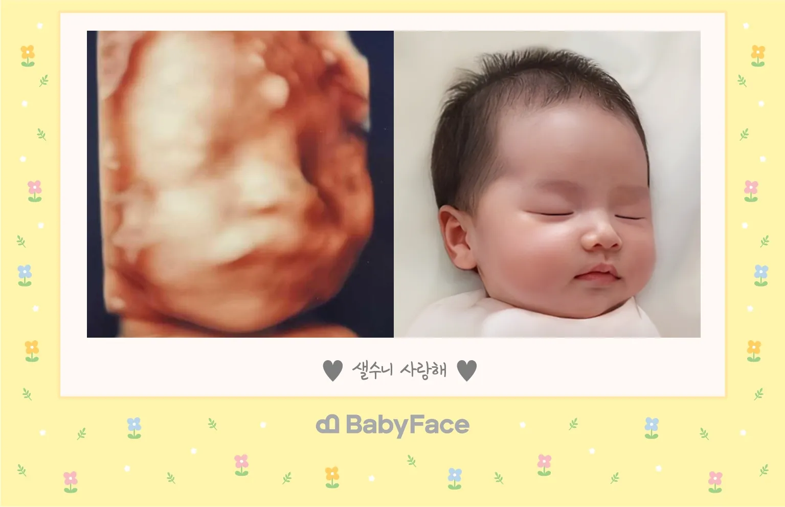 입체초음파...! 요새는 이런것도 되네요??!!