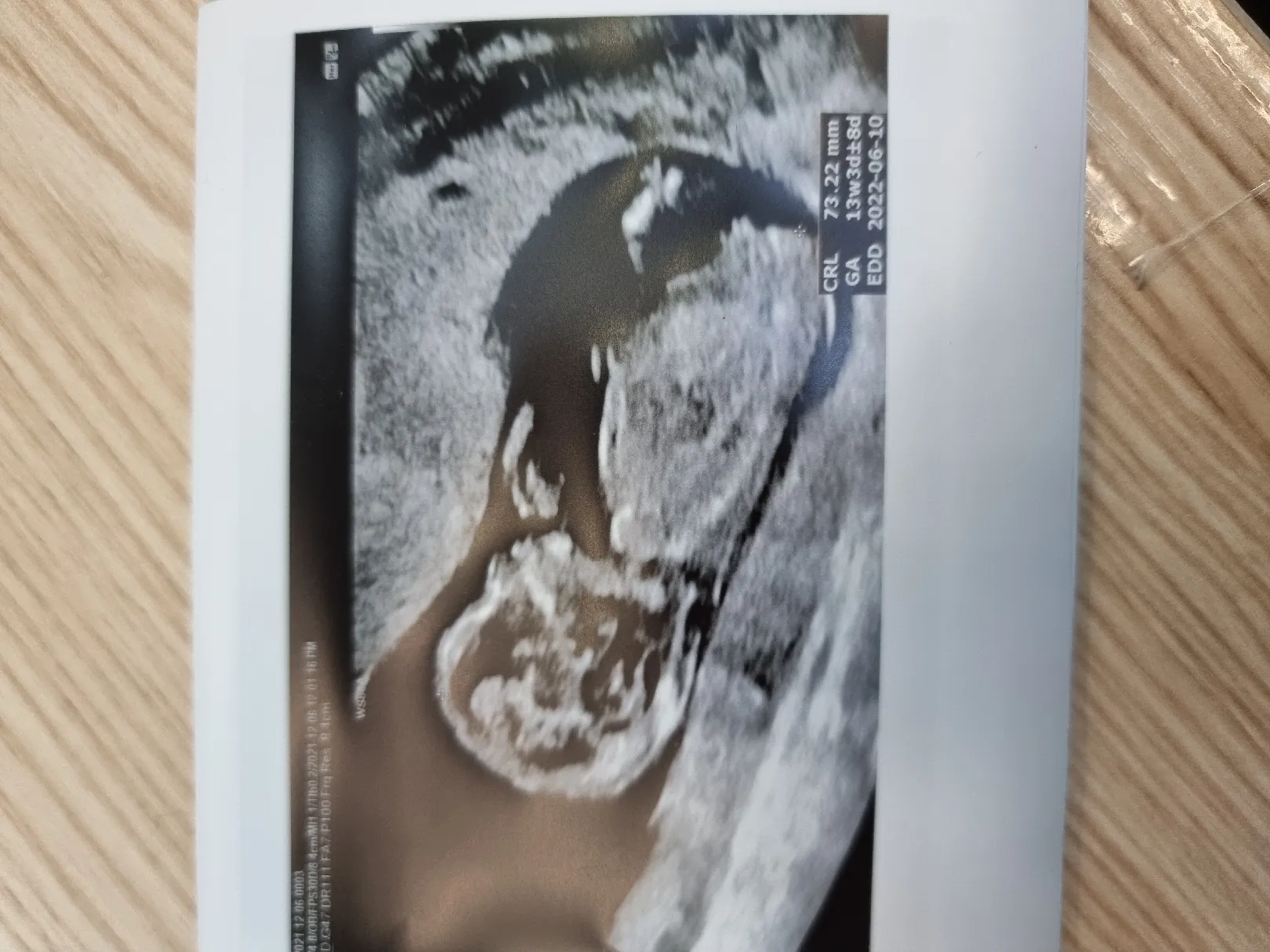 각도법?? 성별이 뭘까요??