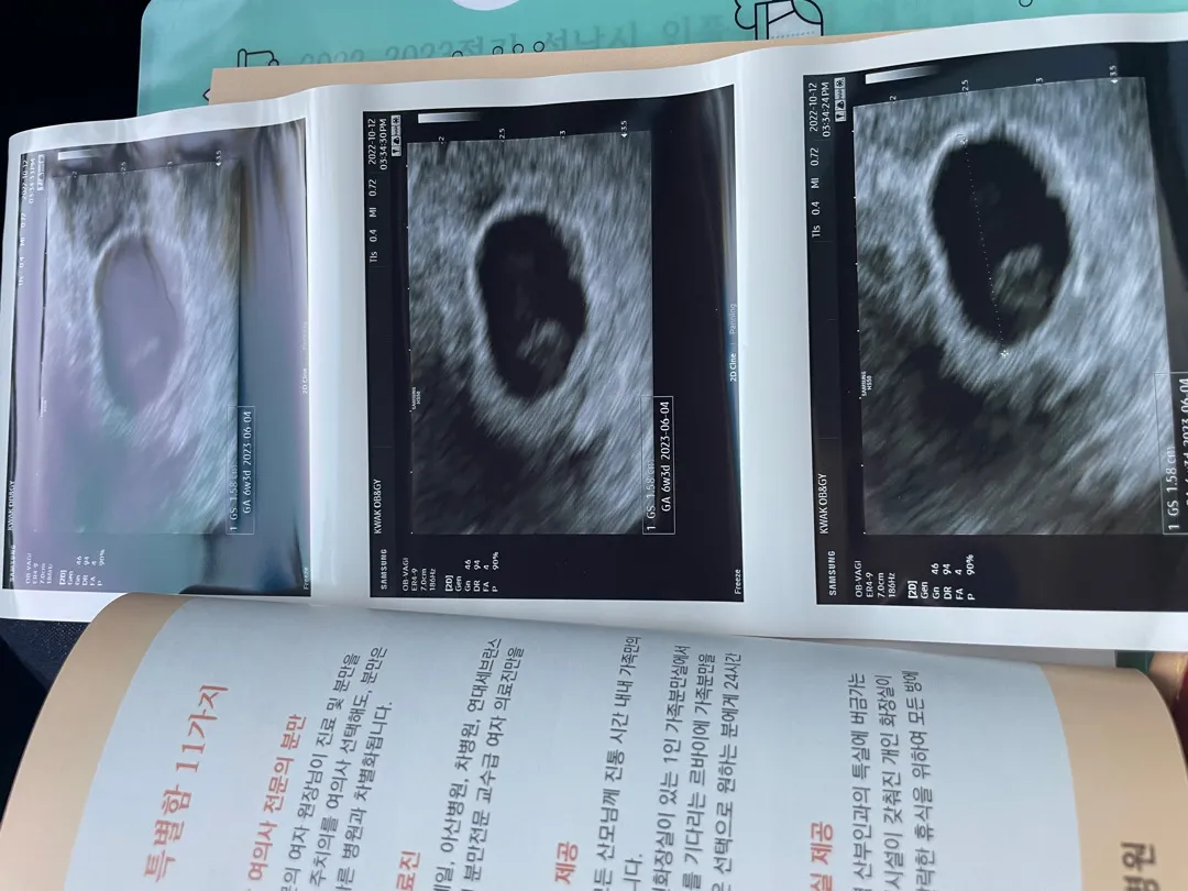 6주 차라는데 심장소리는 못들으신분 ㅠㅠ