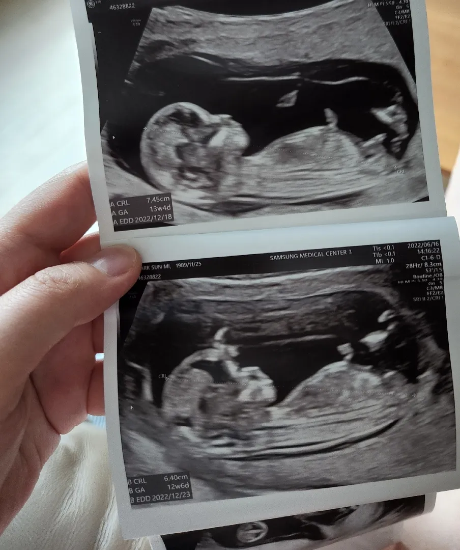 쌍둥이 초음파 성별궁금해요:)