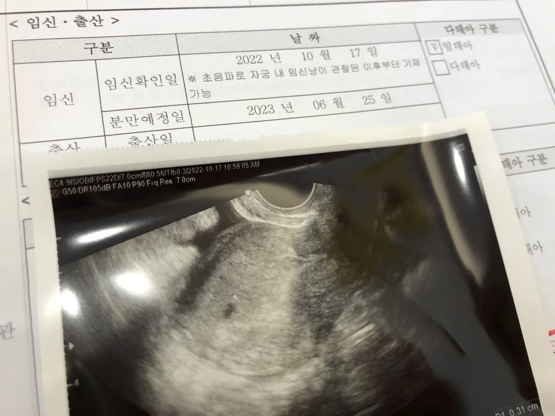 아주 작은 아기집 보고왔어요!