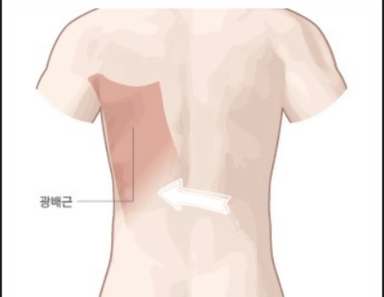 등통증 생겼어요.