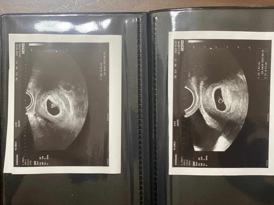 임신 주수가 갑자기 달라졌어요.