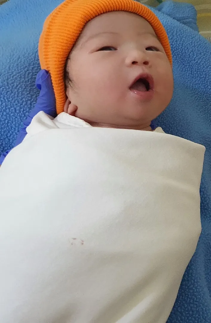 유도실패후제왕절개