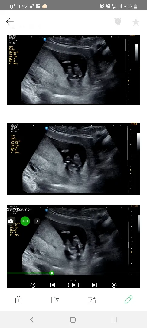 14주1일 의견 구합니다.