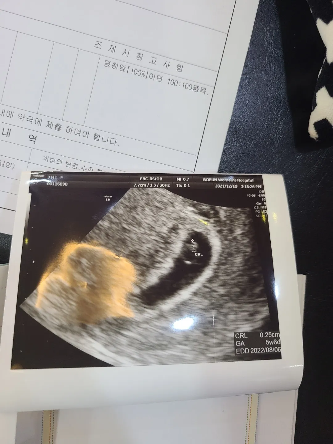 애기집 모양...ㅜㅜ