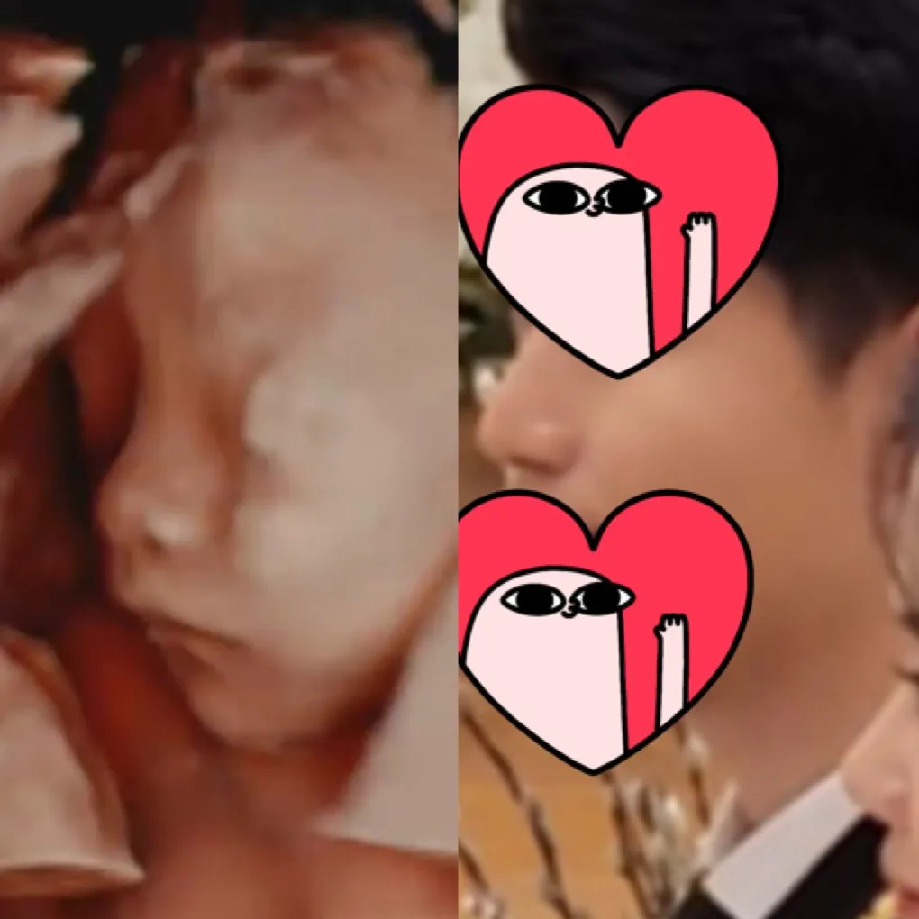 22주 촘파 사진 ㅎㅎ 좀 닮았나요