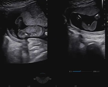 16주2일 성별!