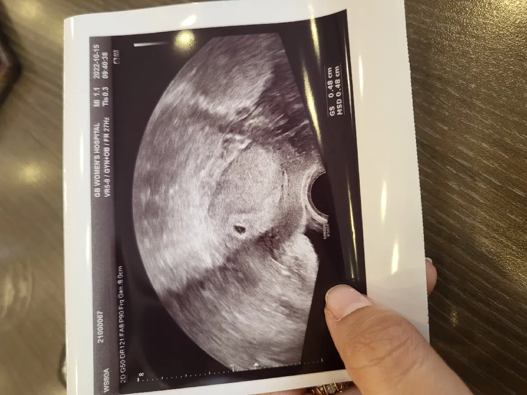5주1일차에 아기집 보고왔어요