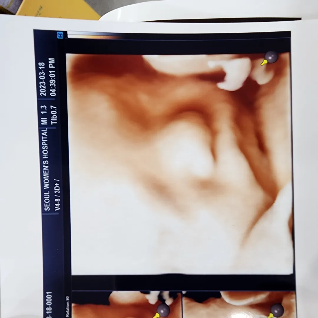 입체초음파 보고왔어용