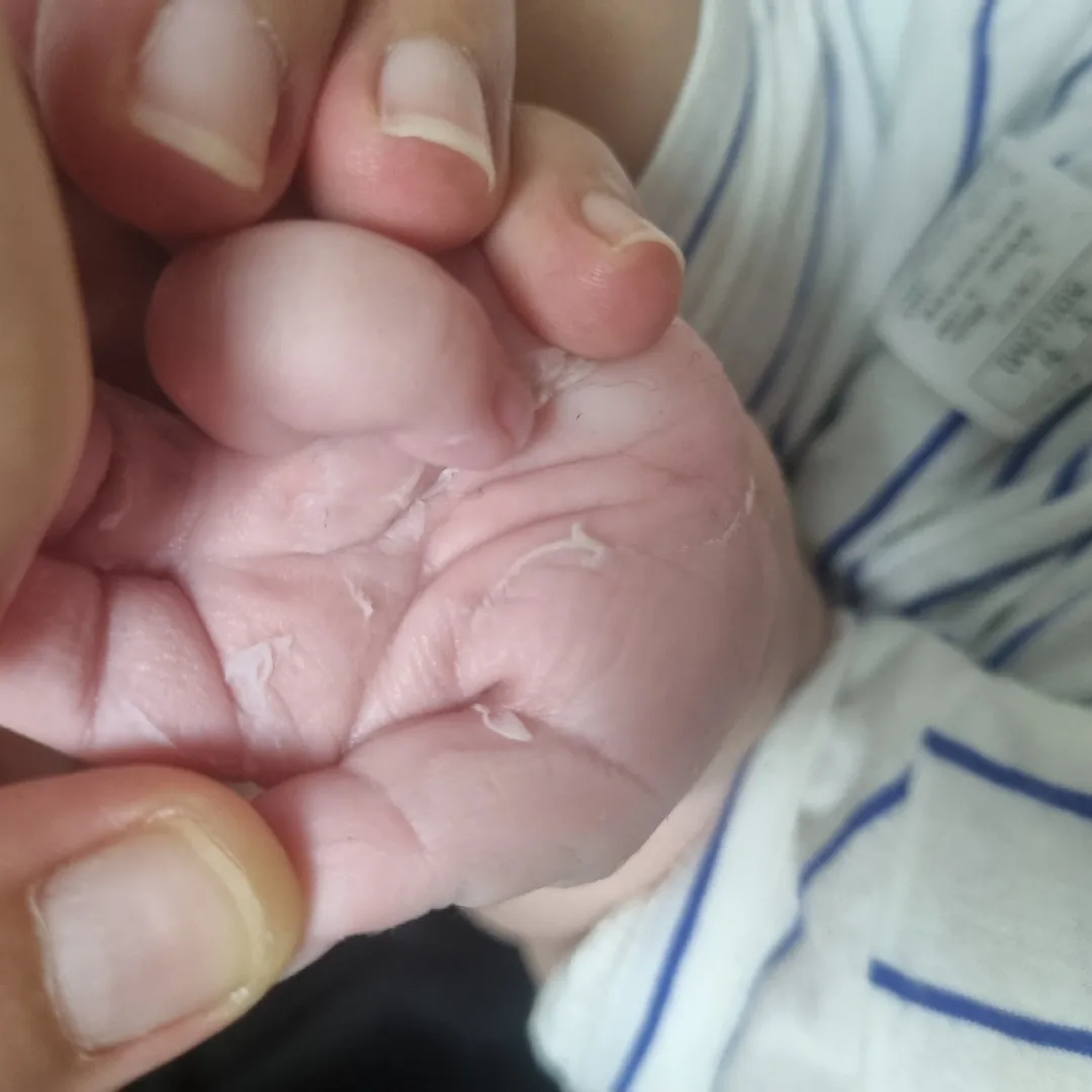5갤아기 손까짐