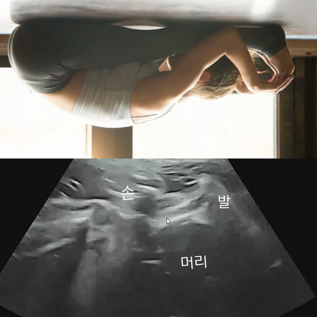 27주 입체초음파 보기 어렵네요ㅠㅠ