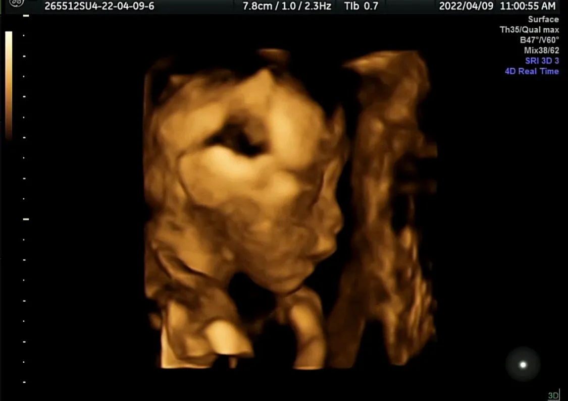 20주차 검진다녀왔어용🧡