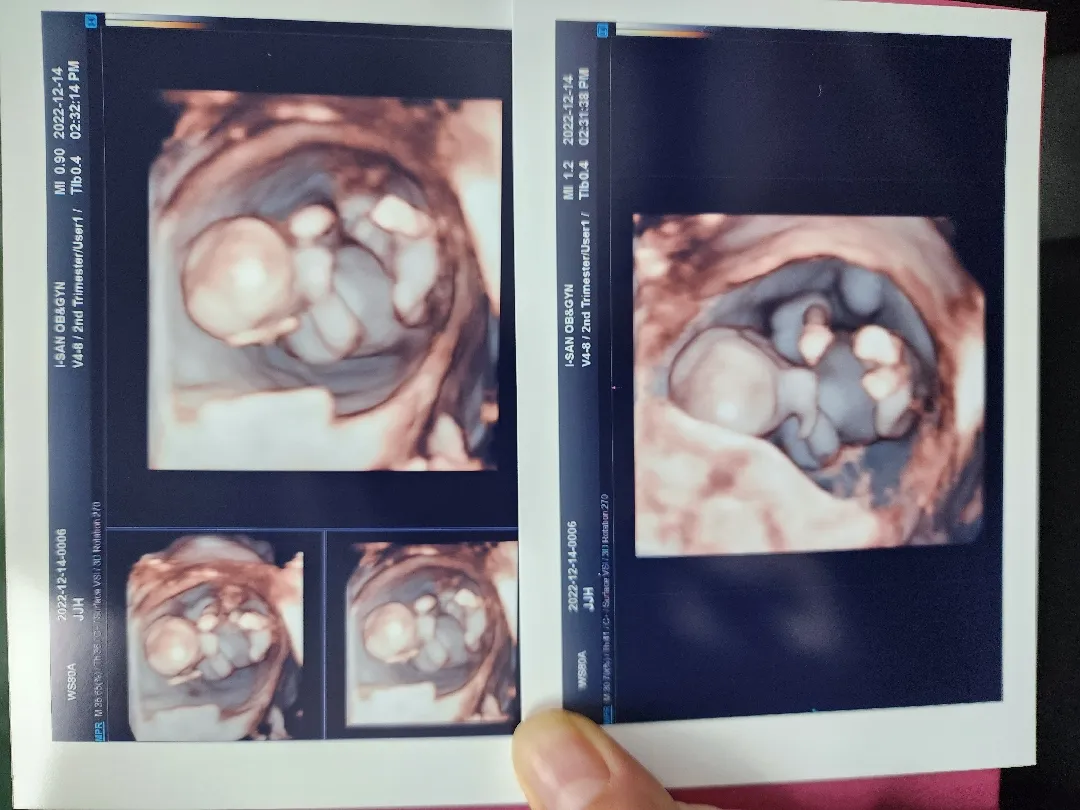 히히 12주 1차검사 받고왔어용