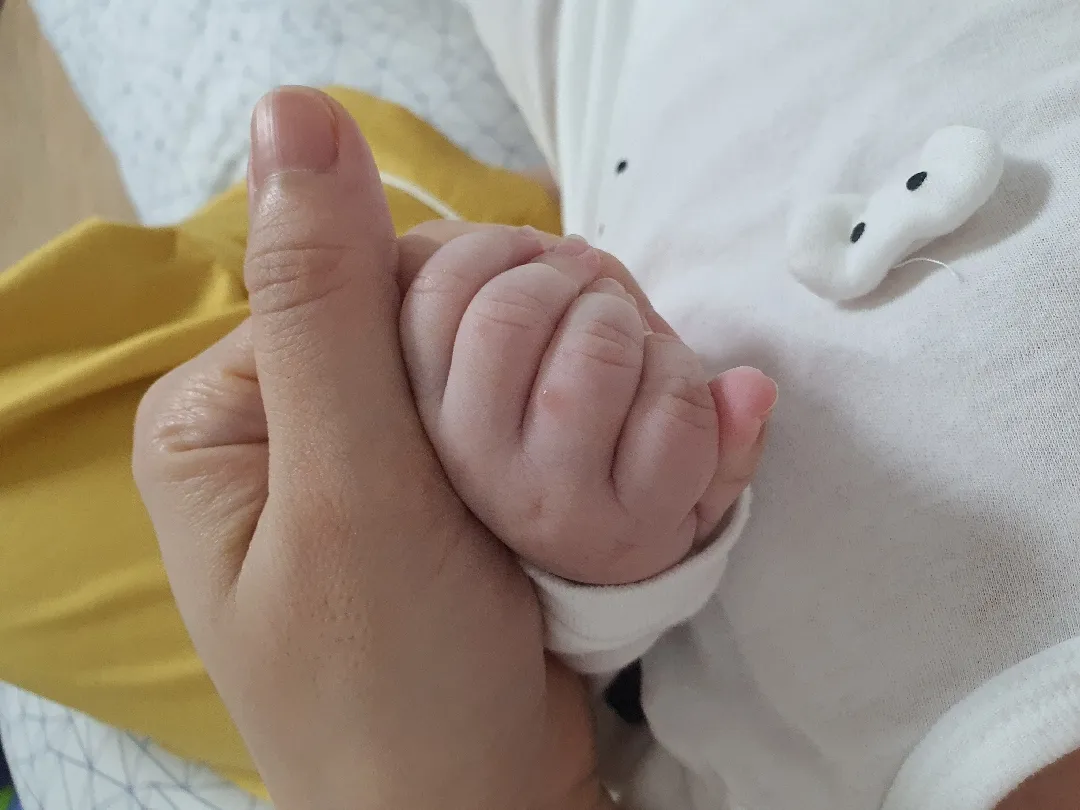 손가락 물집 좀 봐주세요