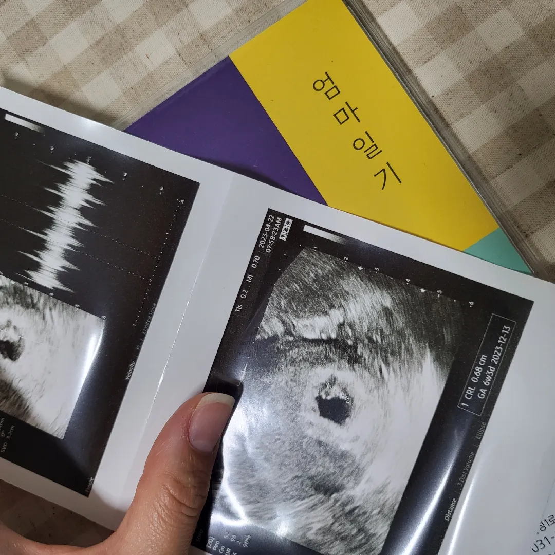 드디어 산모수첩ㅜㅜ