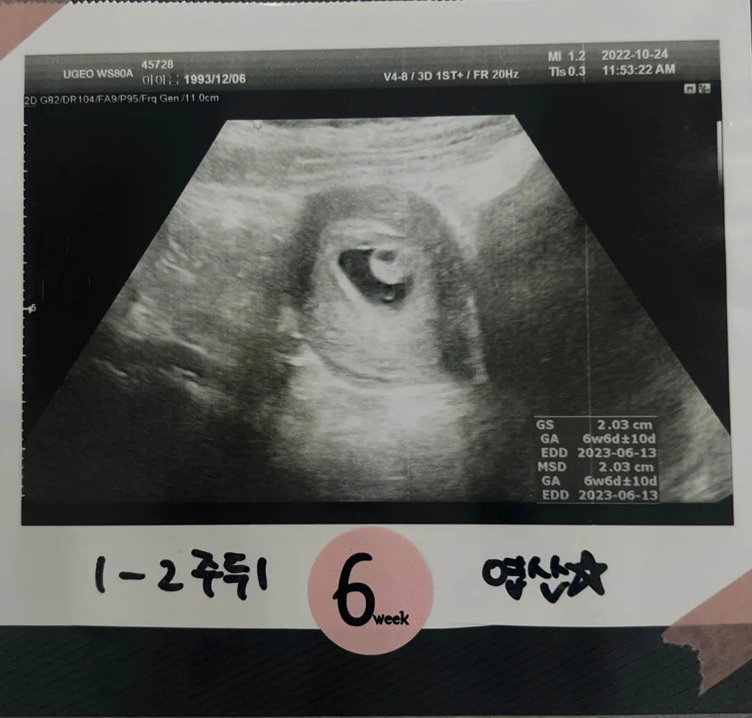 초음파사진 봐주세요
