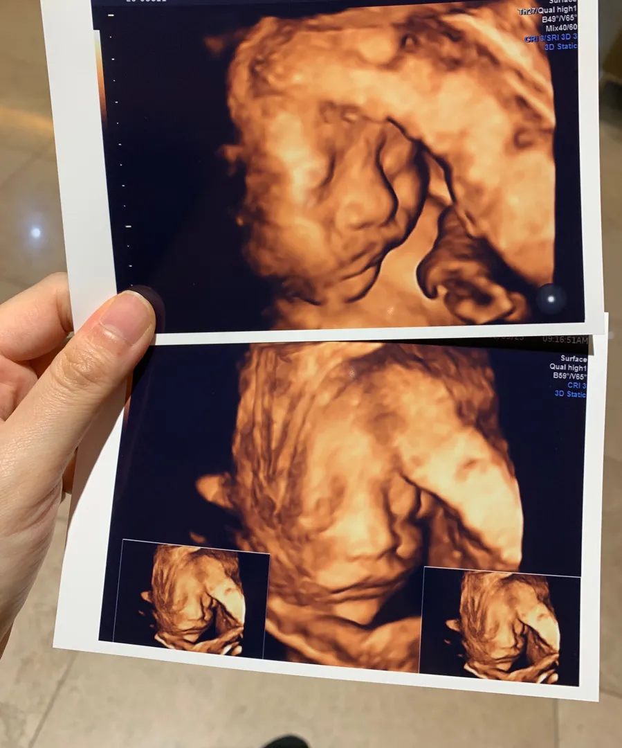 28주 입체초음파 찍고왔어욥!!ㅎㅎ
