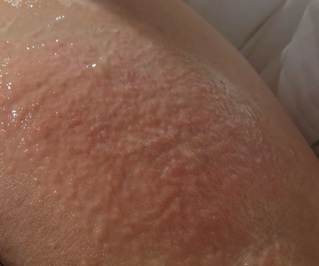 임산부소양증..?(사진주의)