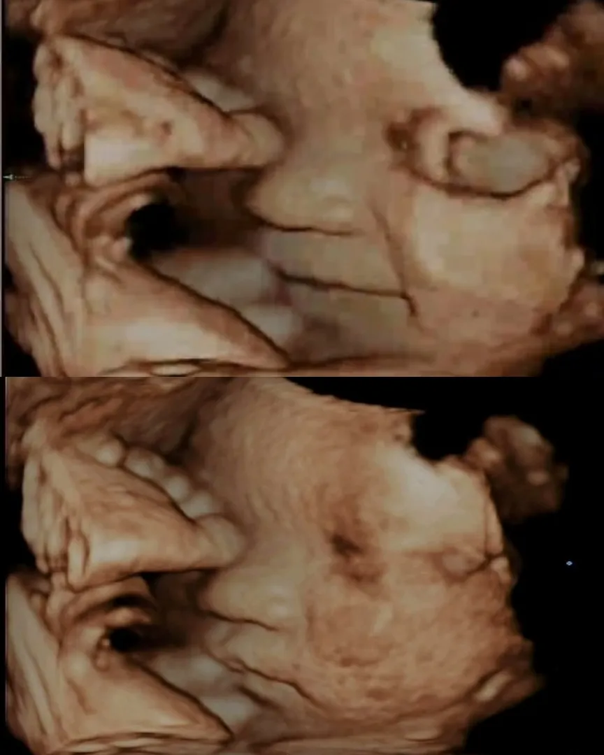 웃는아기🩷👶
