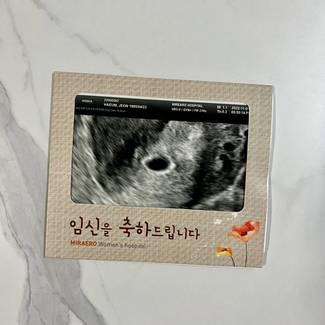 5주2일 아기집 보고 왔어용><!!