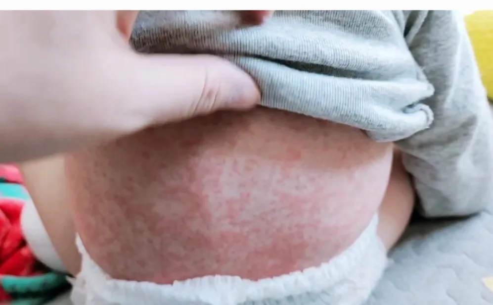 쪼꼬미 안쓰럽네요ㅠ