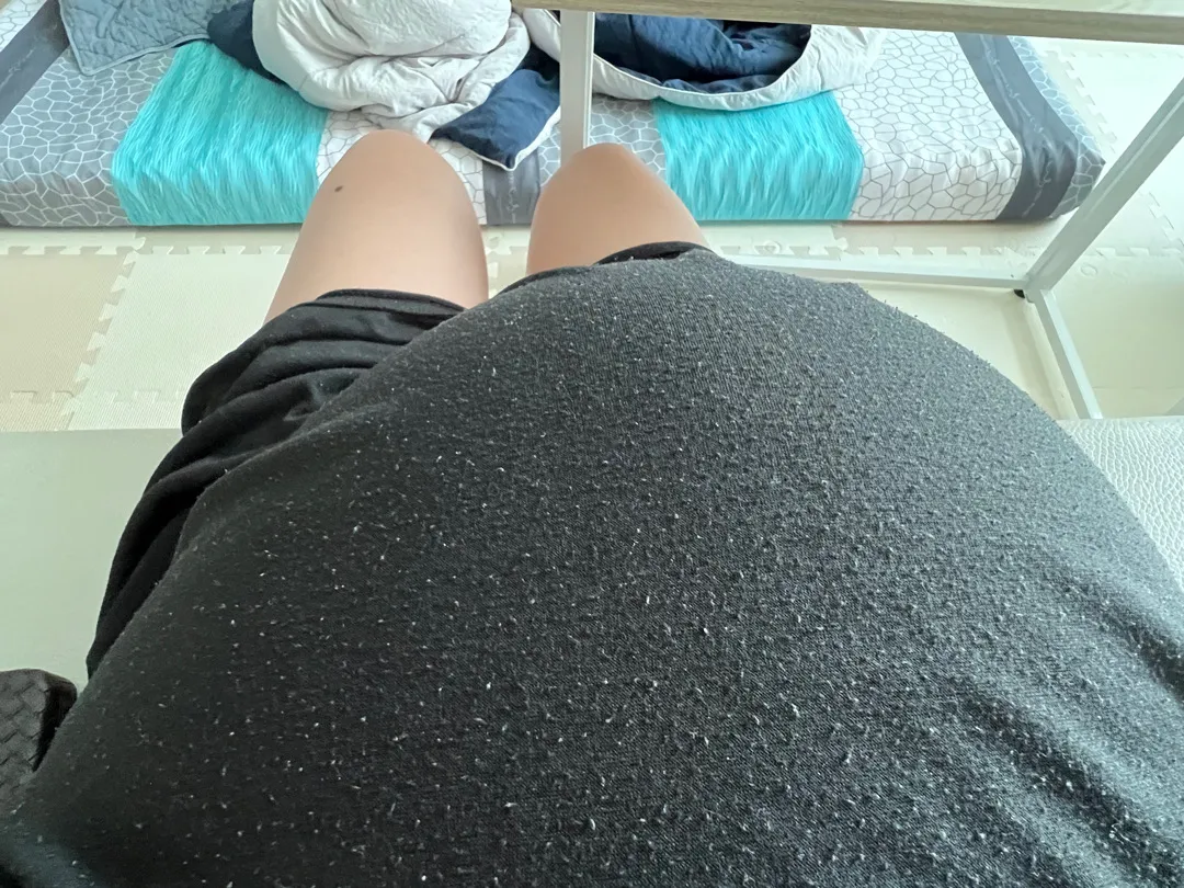 쌍둥이배인데요 한쪽으로 몰리면서 뭉치네요ㅠㅠ