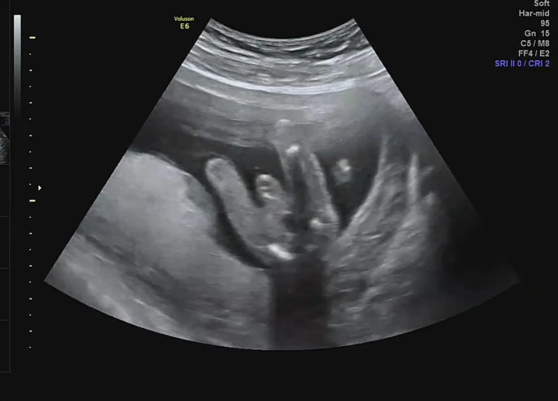 원장님은 잘 모르겠다고 하시는데 베동분들은