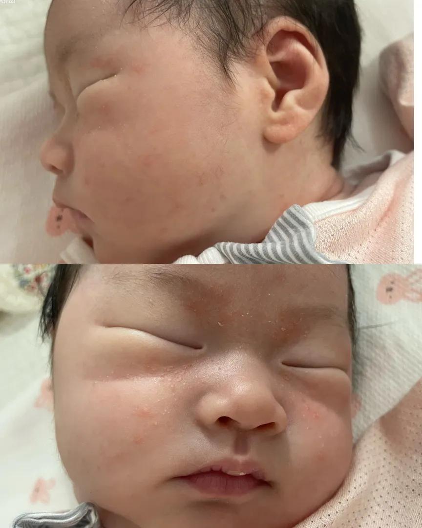 아기 피부 관리 어떻게 해야할까요