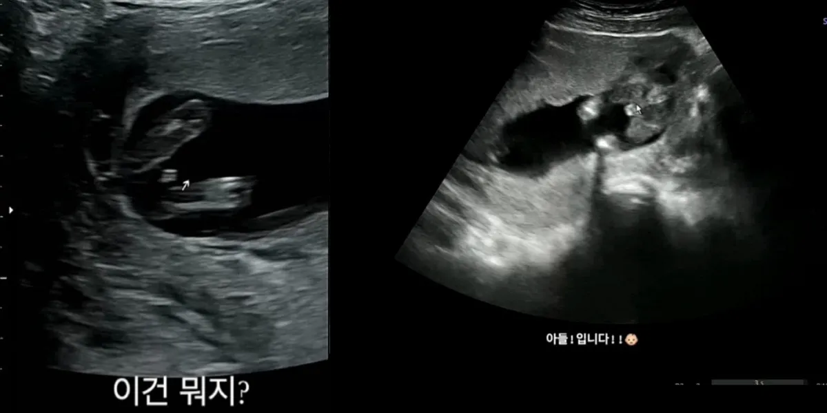 🐰너무나 궁금하던! 우리 아가 성별 알고왔어요👶🏻🧡